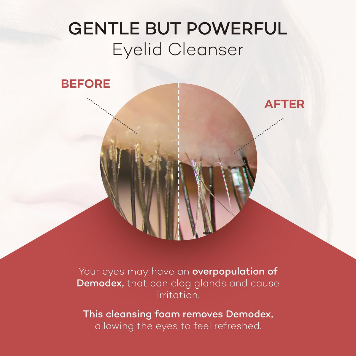 Zocular ZocuFoam applied along eyelid and lash line to remove buildup and soothe skin