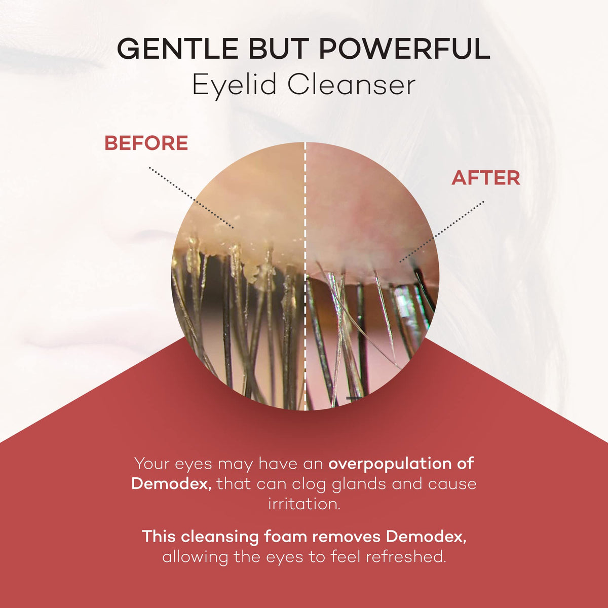 Zocular foam texture on fingertip highlighting mild cleansing action and gentle feel