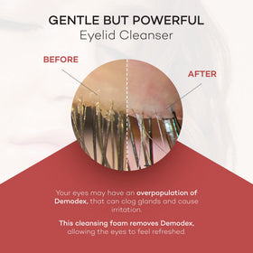 Zocular foam texture on fingertip highlighting mild cleansing action and gentle feel