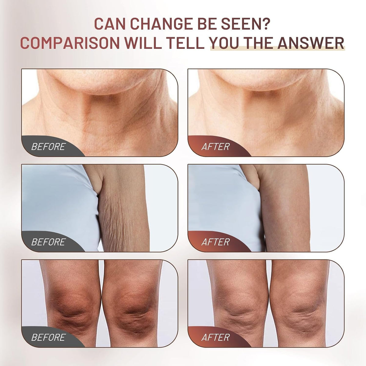 ZZILME cream applied to neck showing improved smoothness and comfortable finish