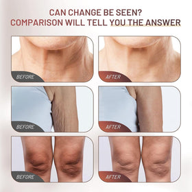 ZZILME cream applied to neck showing improved smoothness and comfortable finish