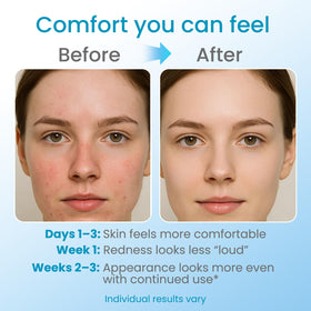 ZZILME product label listing arnica and vitamins, informs ingredient-conscious buyers